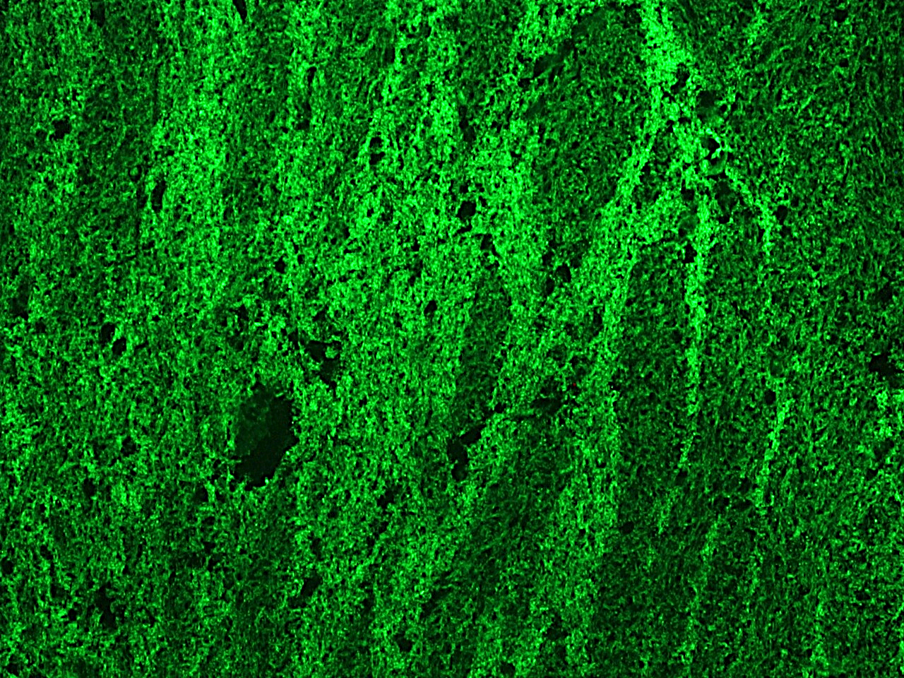 Figure 2. Indirect immunofluorescence staining of reticulon-1C (NSP-C) in frozen tissue section of rat brain using MUB1315P (RNL-4; diluted 1:1000).